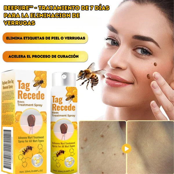 BeePure™ - Tratamiento de adios Verrugas 🐝